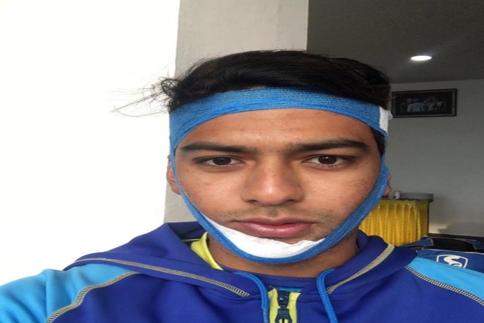 विजय हजारे ट्रॉफी: टूटे जबड़े के साथ खेलते हुए उन्मुक्त चंद ने जड़ा शतक, अनिल कुंबले की दिलाई याद