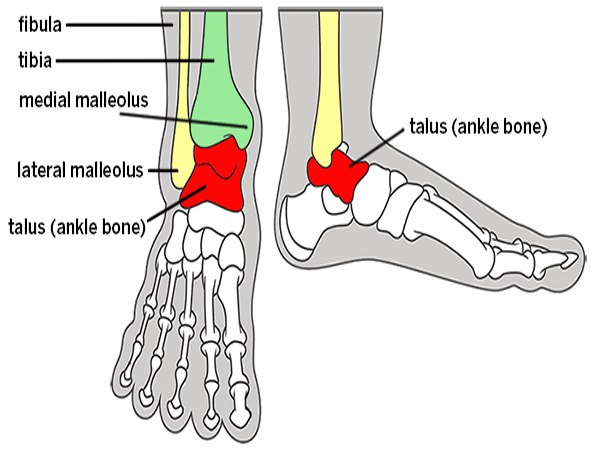 स्ट्रेस फ्रैक्चर के लक्षण क्या हैं?