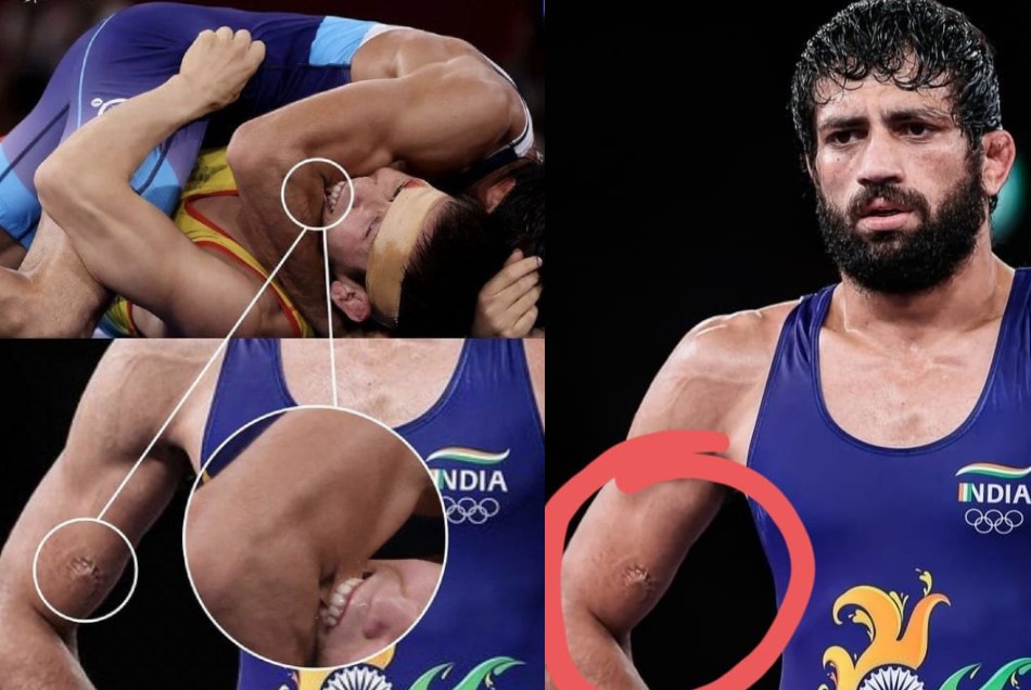 Tokyo 2020: हार सामने देख रवि दहिया के हाथ पर दांत काटने लगा कजाकिस्तानी पहलवान, सहवाग ने लताड़ा